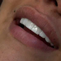 فکی ۱۰ میلیون ، دو فک ۲۰ میلیون|پزشکی|تهران, گلستان (شهرک راه آهن)|دیوار