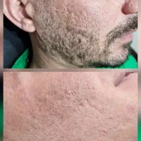 تخفیف 10 تا 20 درصدکلیه خدمات زیبایی در شمس ابادی|خدمات آرایشگری و زیبایی|اصفهان, خلجا|دیوار