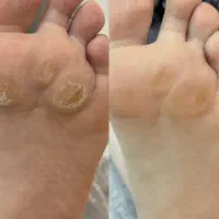 کاشت ناخن|خدمات آرایشگری و زیبایی|محلات, |دیوار