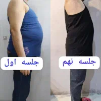 لاغری و پیکر تراشی موضعی با کاهش سایز ۱۵ـ۲۰|خدمات آرایشگری و زیبایی|شیراز, قدوسی غربی|دیوار