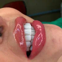 کامپوزیت/لمینیت/ایمپلنت/عصب کشی،و درمانی اقساطی|خدمات آرایشگری و زیبایی|مشهد, جنت|دیوار