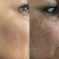 پوست سفید میخوای این تکنیک رو امتحان کن