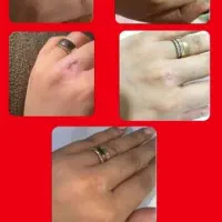 درمان ریشه ای زگیل و تبخال به صورت گیاهی|آرایشی، بهداشتی، درمانی|ساری, |دیوار