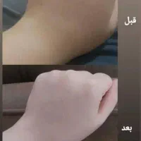کرم‌امارتی|آرایشی، بهداشتی، درمانی|مشهد, مهدی آباد|دیوار