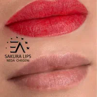 میکروبلیدینگ،فیبروز،شیدینگ،خط چشم. بن مژه