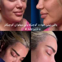 اف آخر سال عمل زیبایی ۱۹ میلیون
