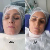 فیشال وهایفوتخصصی باتخفیف یلدایی کلینیک سون