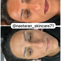 آموزش صفرتاصد پاکسازی وفیشال بامدرک(تخفیف جشنواره|خدمات آموزشی|شیراز, فرهنگ شهر|دیوار