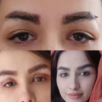 کامپوزیت لمینت بلچینگ روکش بلفارو غبغب لیفت صورت|خدمات آرایشگری و زیبایی|مشهد, فردوسی|دیوار