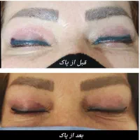 ریمو تاتو  پاک تاتو حتی رنگ های بژ و مشگی