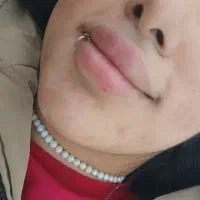 ژل بوتاکس پرسینگ