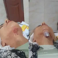 حجامت وزالو درمانی|خدمات آرایشگری و زیبایی|شیراز, مسلم|دیوار