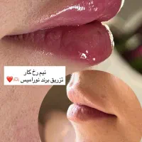 تخلیه چربی شکم و پهلو ترانسفر به باسن