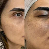 فیشال تخصصی صورت و بدن