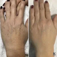 فشیال و پاکسازی پوست تخصصی و کلینیکال|خدمات آرایشگری و زیبایی|سبزوار, ولیعصر (نجار آباد)|دیوار