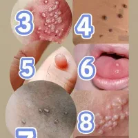 وقت درمانه دیگه