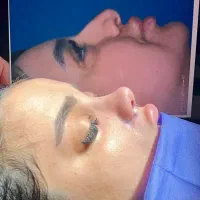 عمل زیبایی بینی و ترمیمی