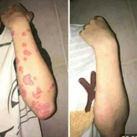 پوست