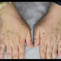 خالبرداری ، کک ومک ...تضمینی