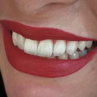 آموزش حرفه ای کامپوزیت لبه شیشه ای