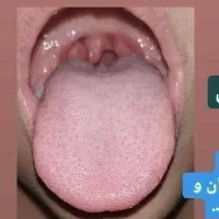 درمان بیماری‌ها با طب سنتی و همچنین آموزش طب سنتی