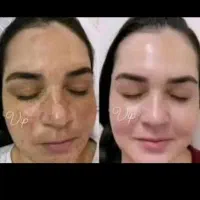 بهترین کرم پوست|آرایشی، بهداشتی، درمانی|کرج, احدآباد|دیوار