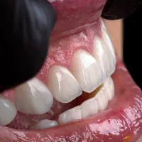 دندانپزشکی تمام دیجیتال افسریه با پایین ترین قیمت