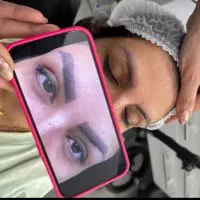 ریموو تخصصی(پاک کردن تتو صورت و بدن)