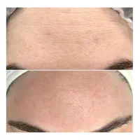 جوانسازی فوری/در یک جلسه/در یک ساعت|خدمات آرایشگری و زیبایی|رشت, کوی حسینی|دیوار