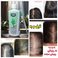تونیک تقویت کننده مو هیرفرند