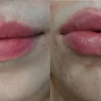 فیلر،بوتاکس،لیزر موهای زاید و جوانساز زیر نظر پزشک