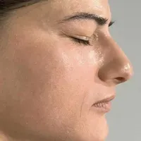 خدمات حرفه ای تخصصی،لک کک مک موی زائدسفیدالکترولیز|خدمات آرایشگری و زیبایی|قم, صفائیه|دیوار