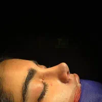 جراحی بینی جراح متخصص مهدی عالی فقط ۴۵|خدمات زیبایی و سلامت|تهران, صاحبقرانیه|دیوار