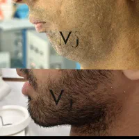 جراحی فک و صورت بعد از ارتودنسی با تعرفه دولتی