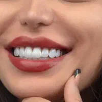 کامپوزیت دندان