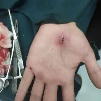 تزریقات،پانسمان،بخیه،سوند و سرم،خدمات پرستاری منزل|خدمات زیبایی و سلامت|کرمانشاه, |دیوار