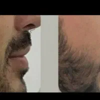 میتونی همچین ریشی داشته باشی