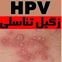 بهبود کامل زگیل و تبخال بدون لیزر و فریز