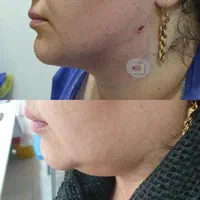 تخفیفات زیبایی و عملهای جراحی|خدمات آرایشگری و زیبایی|دوگنبدان, |دیوار