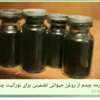 نورانیت چشم