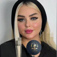 تزریق تخصصی ژل ومادلینگ خلیجی واروپایی وبوتاکس|خدمات آرایشگری و زیبایی|کرمانشاه, |دیوار