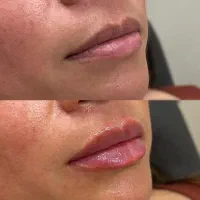 کلینیک زیبایی،ژل.بوتاکس و بلفاروپلاستی|خدمات زیبایی و سلامت|تهران, نیروی هوایی (پیروزی)|دیوار