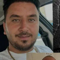 کاشت مو.ابرو.ریش.فول تراکم با شرایط استثنایی|خدمات آرایشگری و زیبایی|شیراز, ستارخان|دیوار