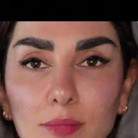 مدل برای بوتاکس وژل