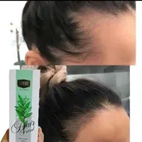 تونیک هی فرند قاتل ریزش مو