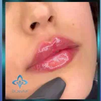 در کلینیک زیبایی ما توسط پزشک باسابقه زیباتر شوید|خدمات آرایشگری و زیبایی|قرچک, مهدیه|دیوار