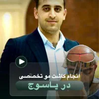 تخفیف ویژه کاشتمو تخصصی در یک روزه از دستش نده