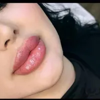 تزریق فیلرهای بدن(دست-مچ پا-باسن)ساکشن غبغپ|خدمات آرایشگری و زیبایی|اصفهان, ملک‌شهر|دیوار