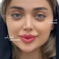 جشنواره تخفیف تزریق ژل و بوتاکس کانتورینگ فیشیال|خدمات آرایشگری و زیبایی|کرج, گلشهر|دیوار