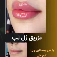 کاشت مو و ابرو / بوتاکس / چربی ژل /کلینیک /زیبایی|خدمات آرایشگری و زیبایی|بوکان, |دیوار